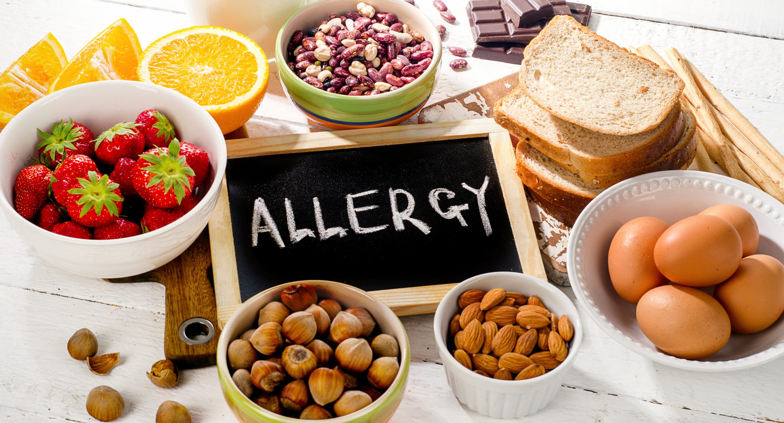 Food allergy. Allergic food on white wooden background.