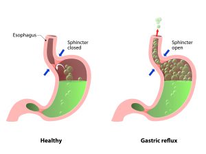 how-to-heal-your-gut